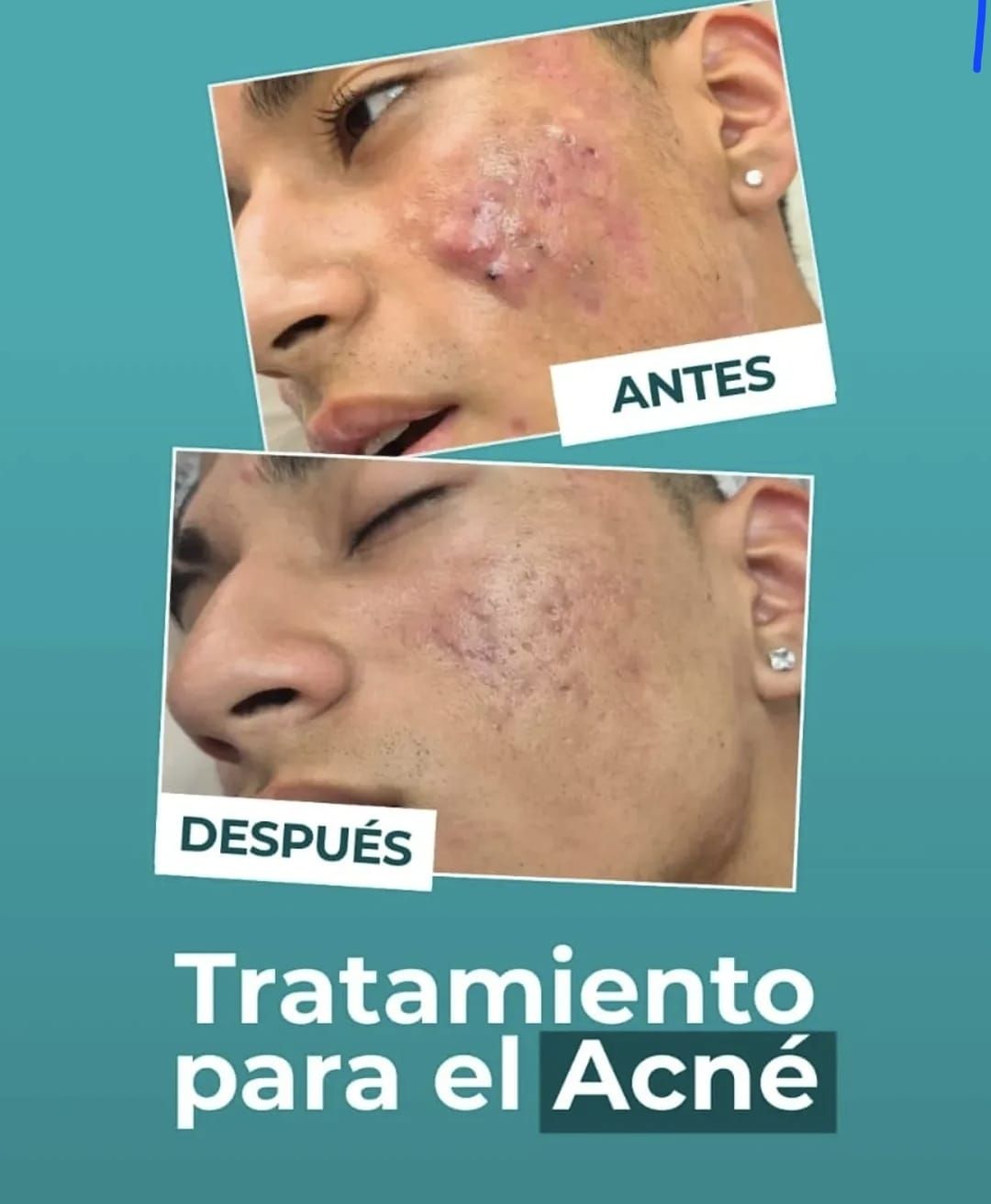 Zobeida Molina-2