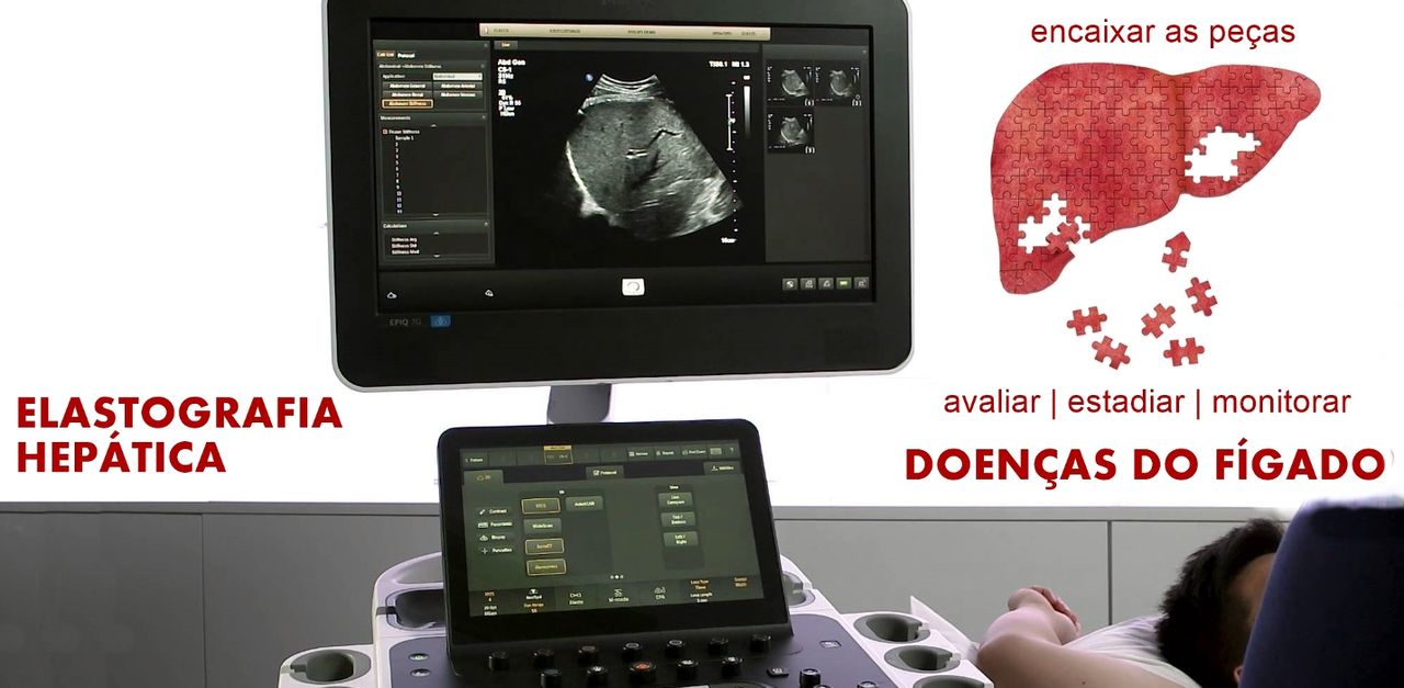 Elastografia  Hepática Por Ultrassom-2