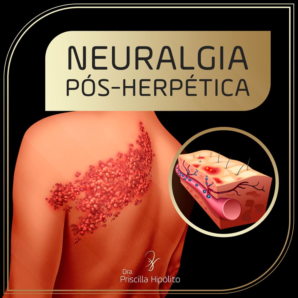 Priscilla Hipólito-6