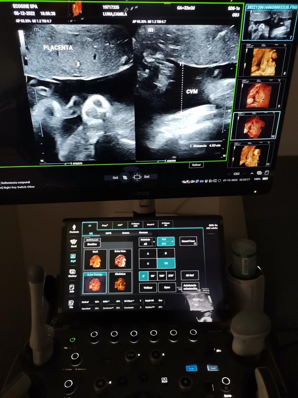 Marcelo Fierro Jarrin-9