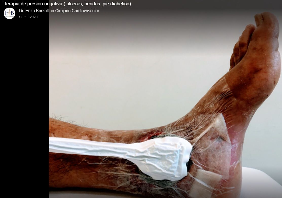 Enzo Borzellino Yepez-7