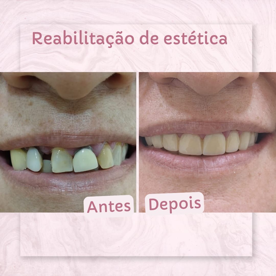 Ana Carla Rocha De Araujo-0