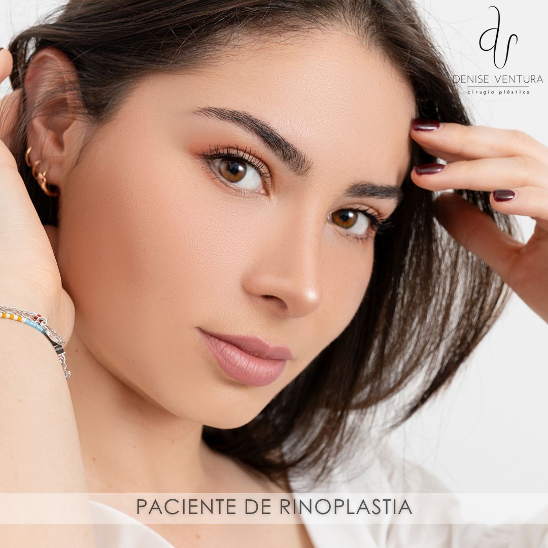 Denise Ventura Perez-12