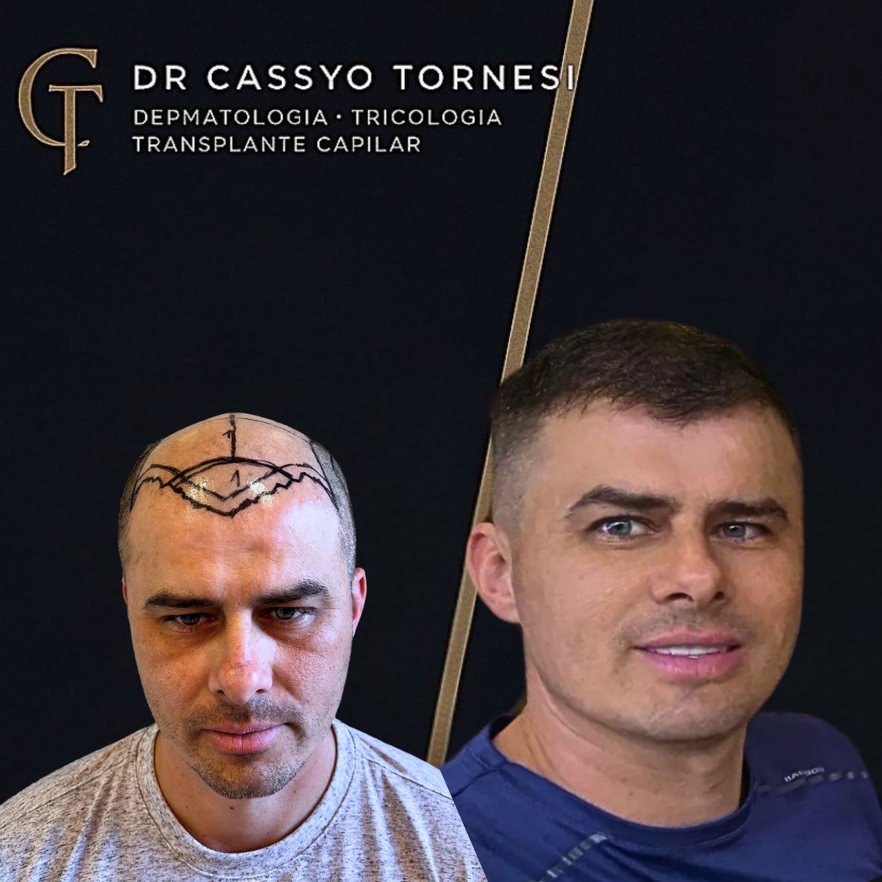 Cassyo Tornesi-14