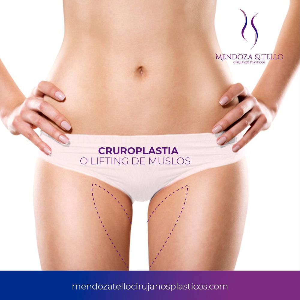 Liliana Tello Quijano-35