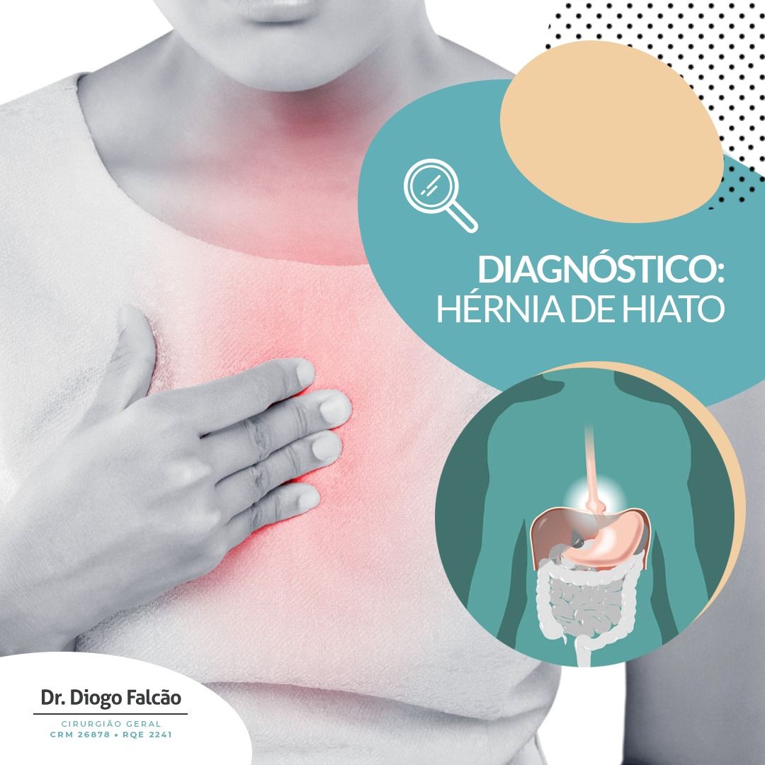 Diogo Parente Falcão-28
