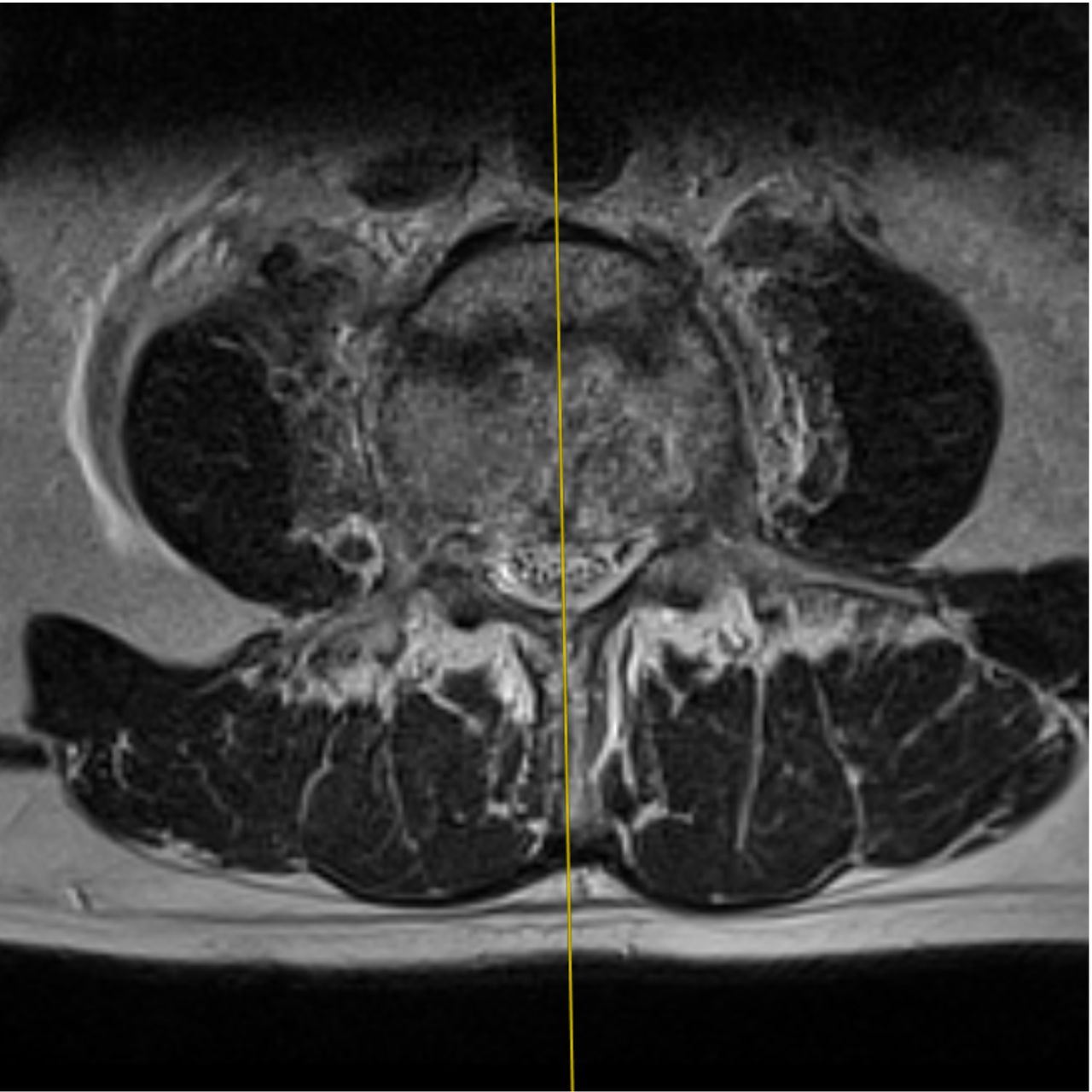 David Tafur Muñoz-1515