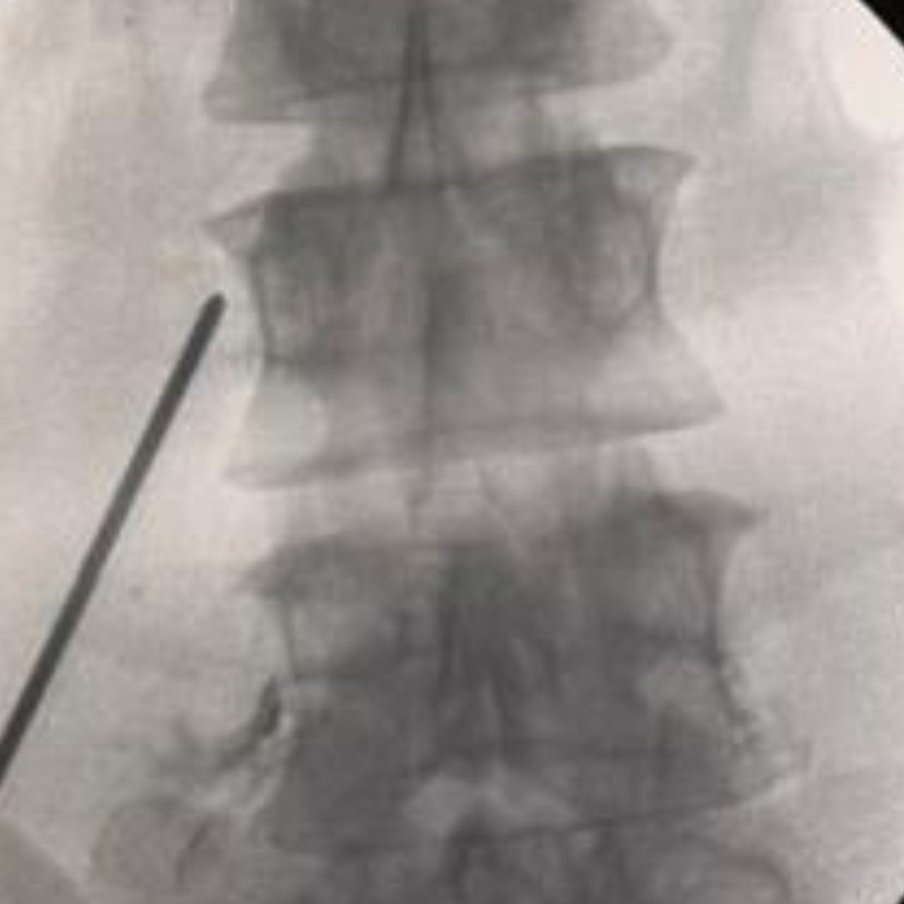 David Tafur Muñoz-1934