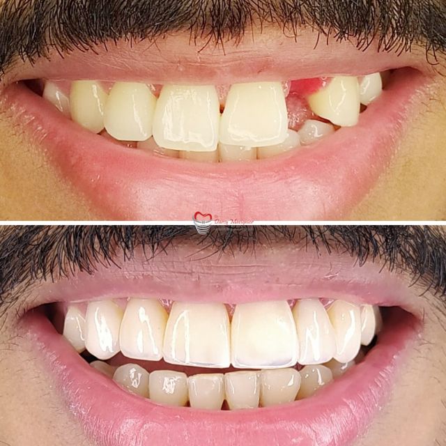 Darcy Furtado Mavignier Neto-4