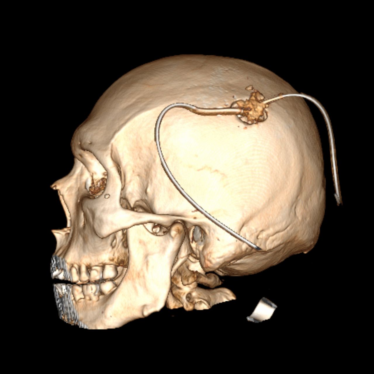 David Tafur Muñoz-2481