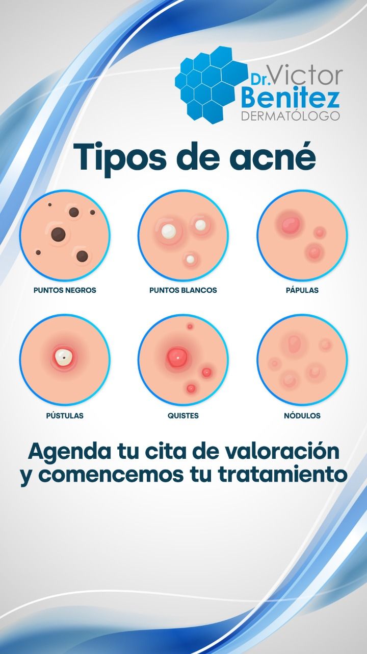 Victor Adolfo Benitez Campo-7