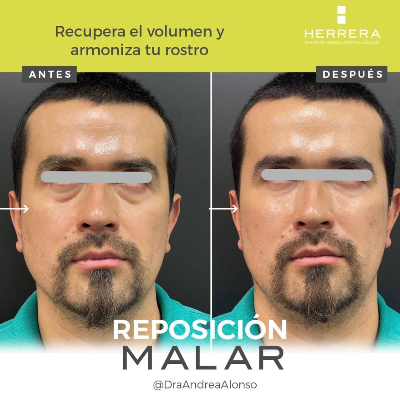 Andrea Alonso Herrera-9