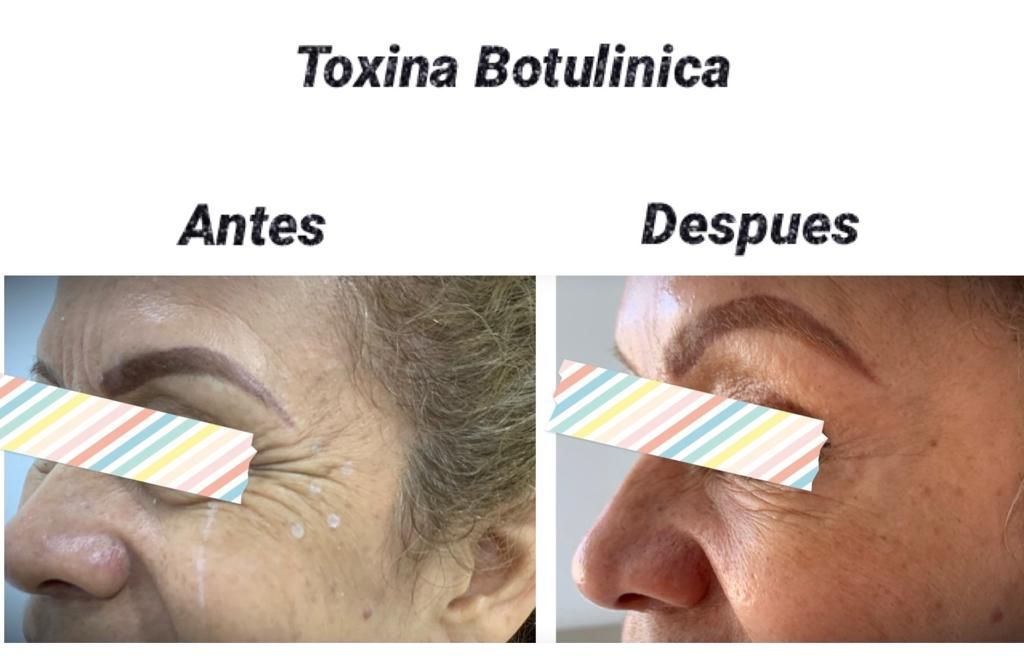 Maria Gisela Angel Losada-85