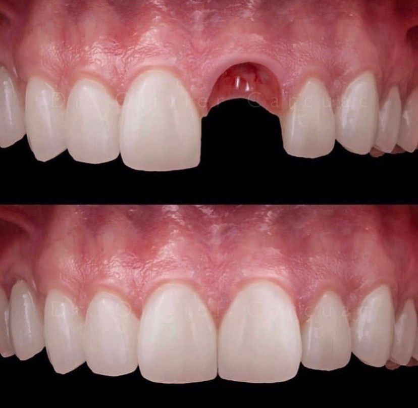 Leandro Ponte Dias-43