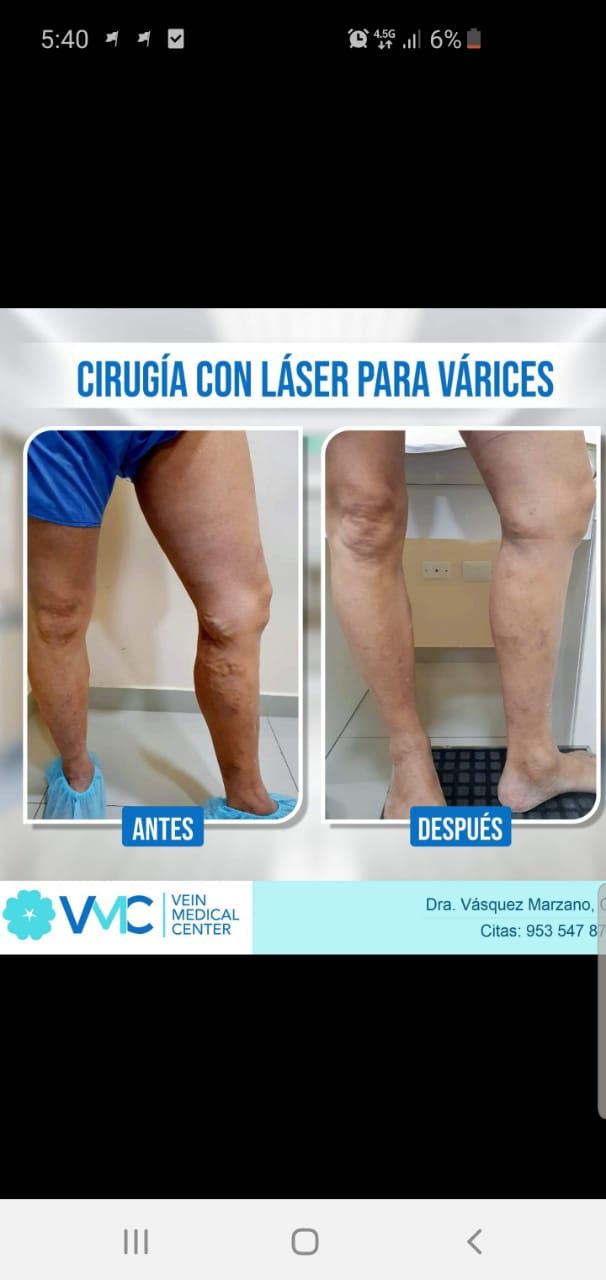 Cindy Vásquez Marzano-22