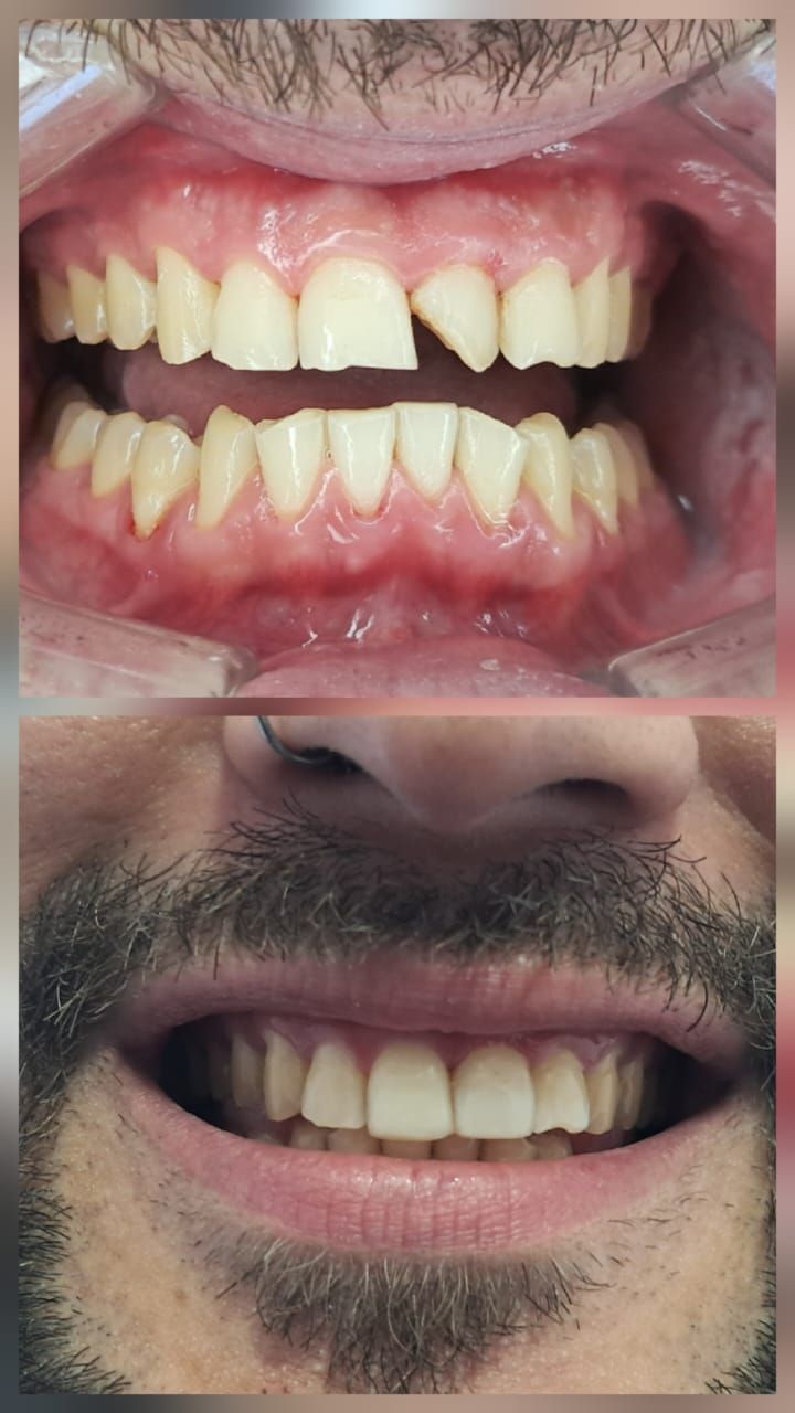 Yuset Almeida Urquiaga-3