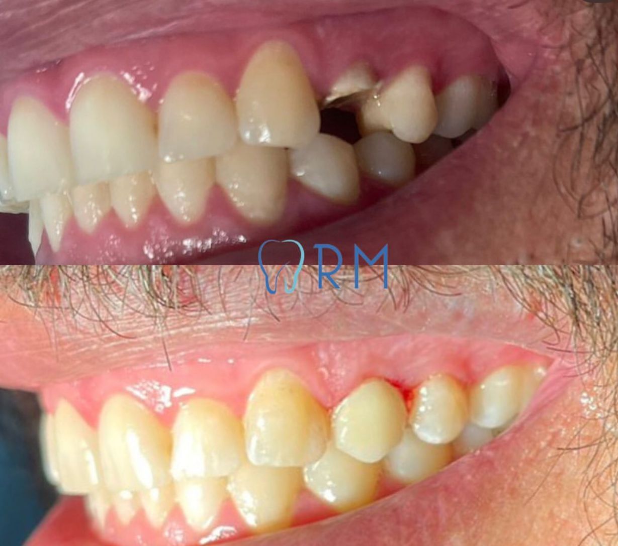 Rafaela Maria Silva Moreira-5