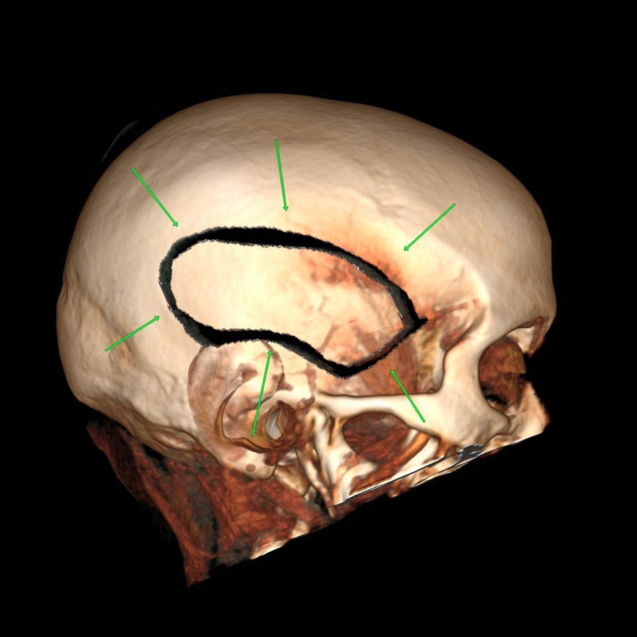 David Tafur Muñoz-1323
