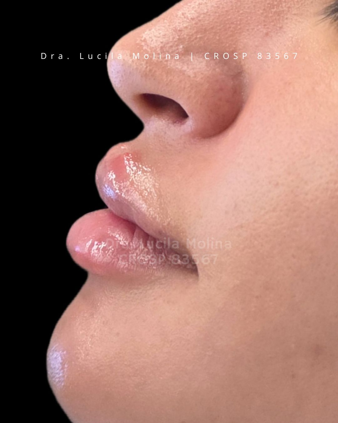 Lucila Molina-2