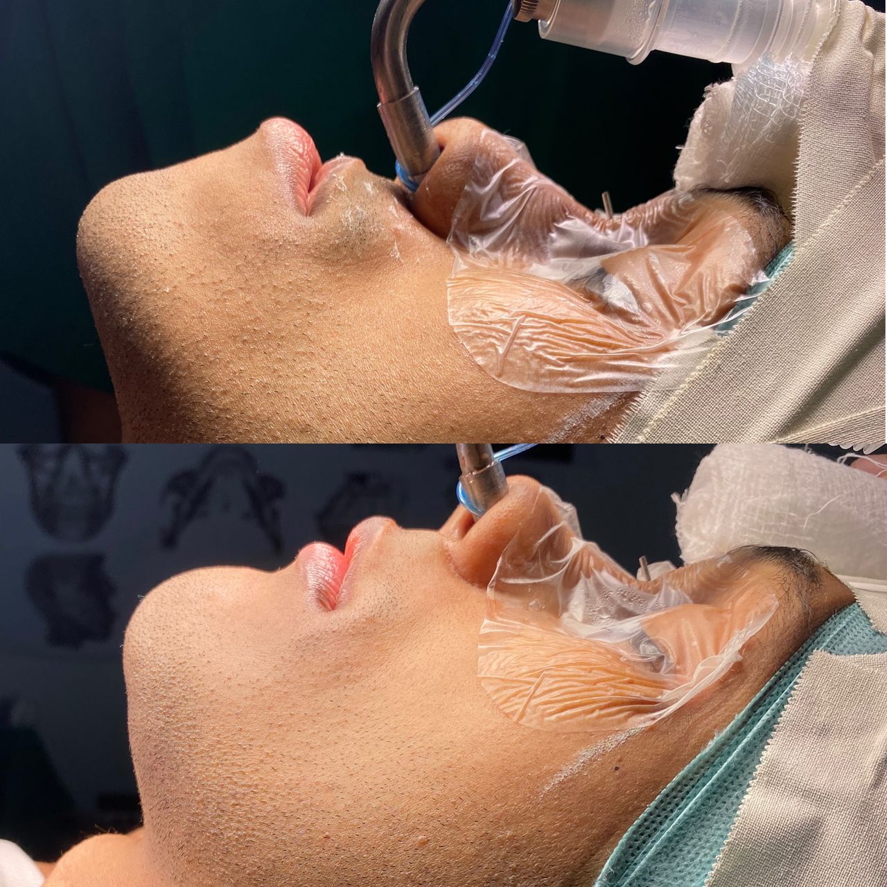 Raffael Maron Vieira De Noronha-31