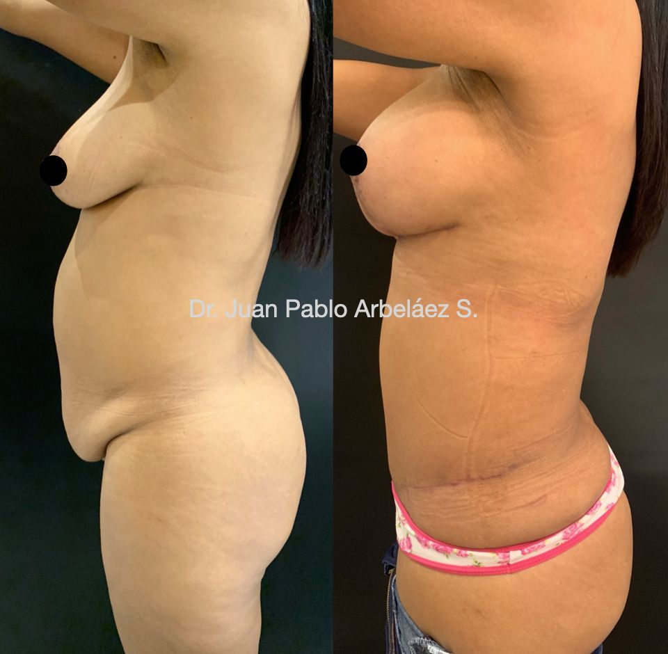 Juan Pablo Arbeláez Sierra-18