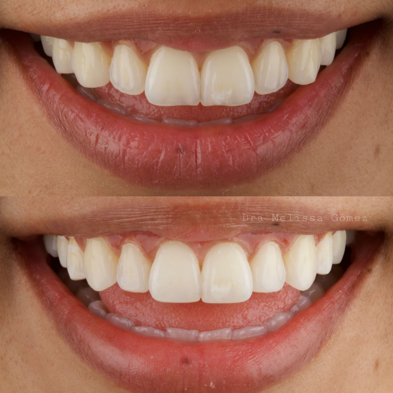 Melissa Gómez Arango-18