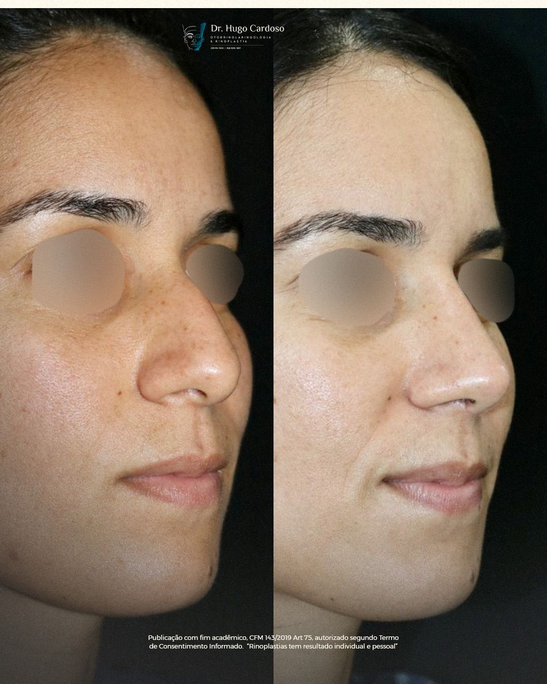 Hugo Cardoso De Oliveira-14