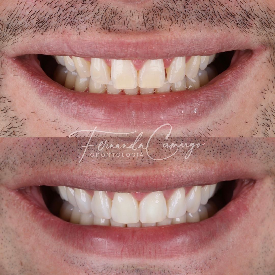 Fernanda Camargo Silveira-4