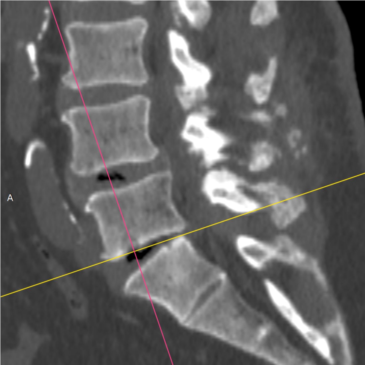 David Tafur Muñoz-2466