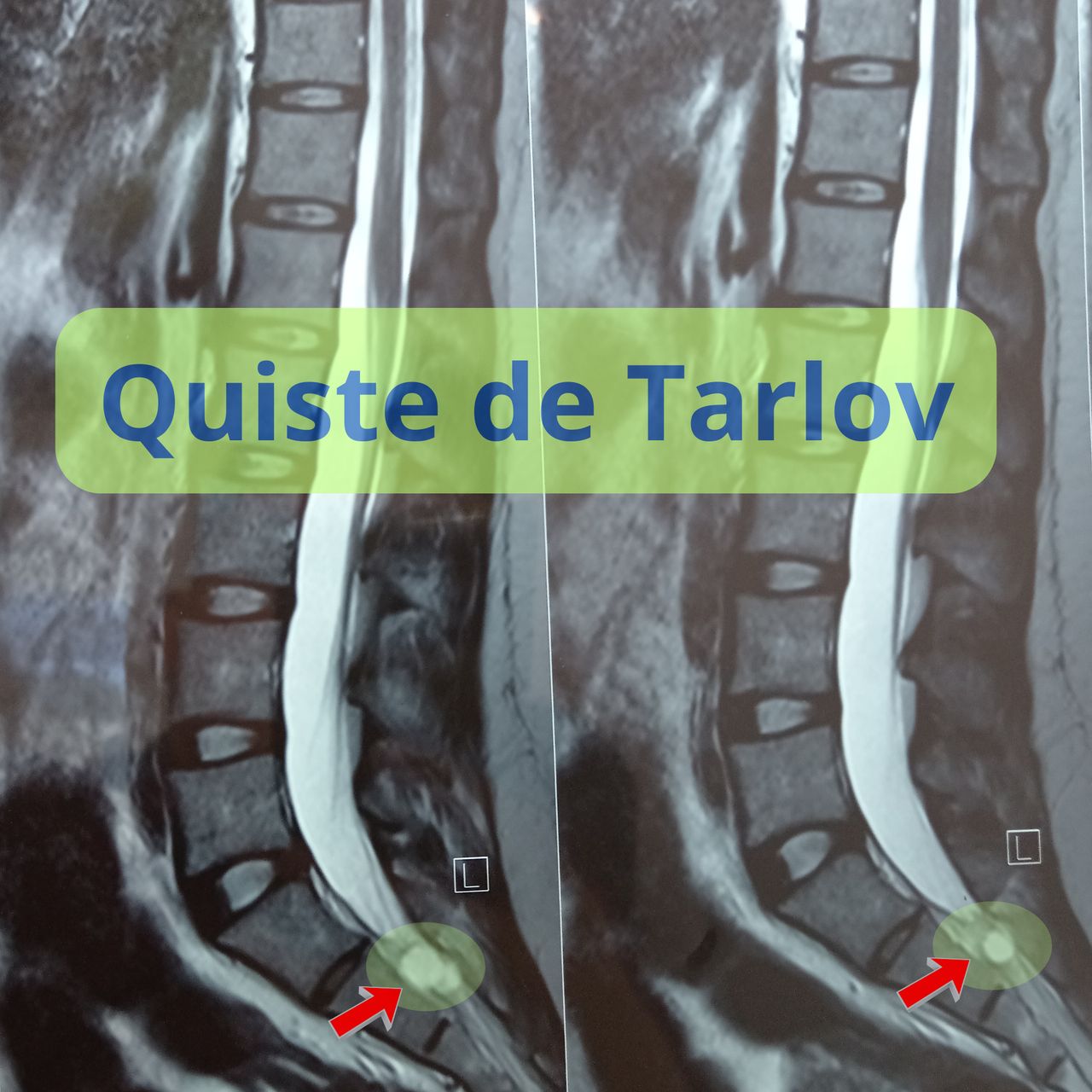 David Tafur Muñoz-1252