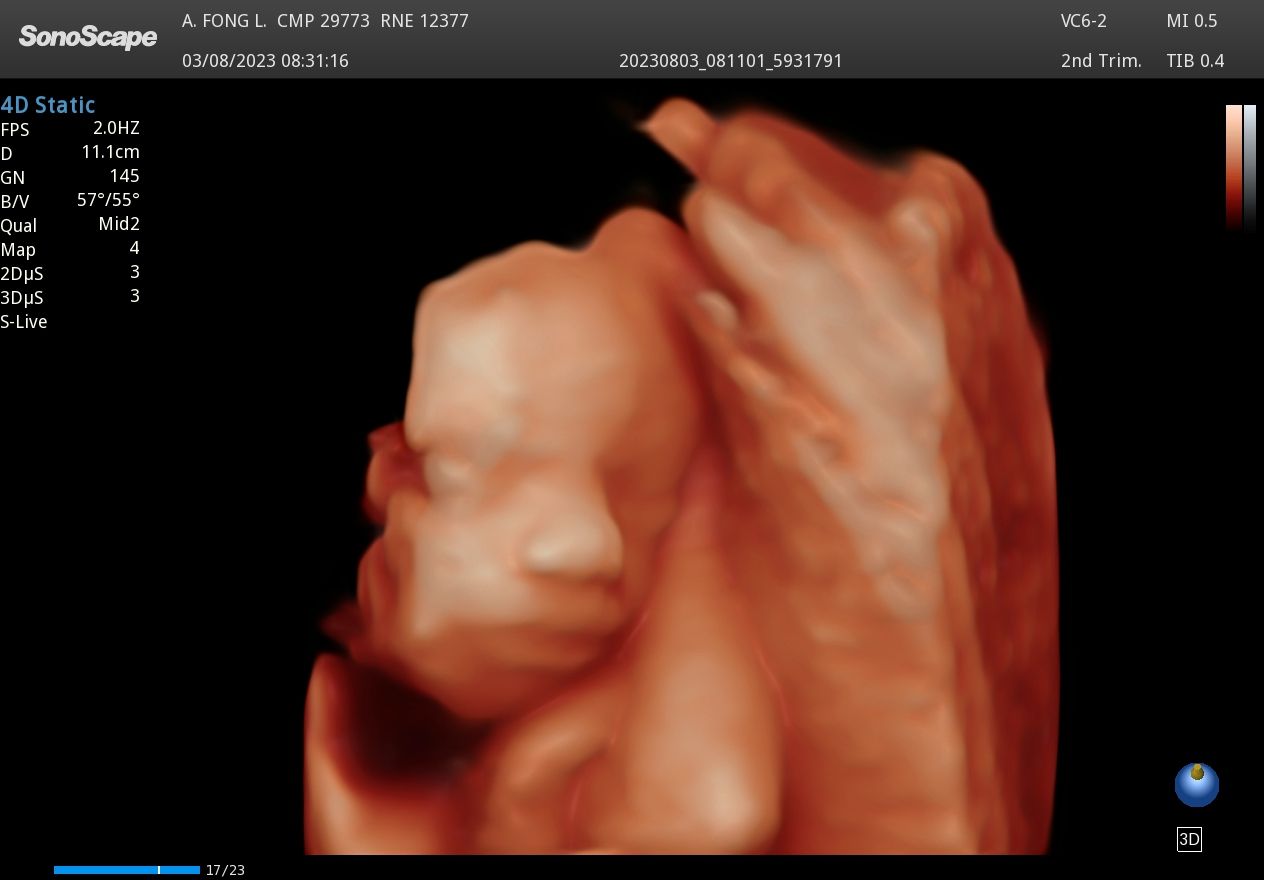 Armando Efren Fong Lei-4