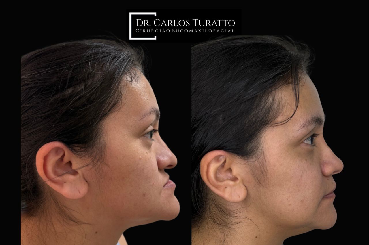Carlos Turatto-3