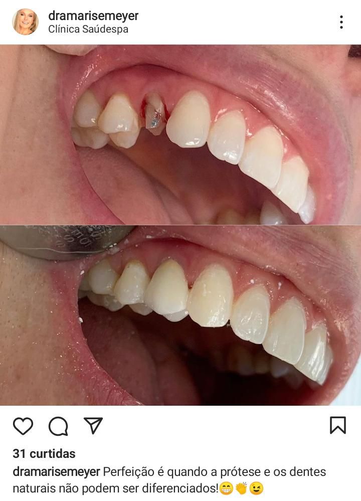 Marise Meyer Jamur-1