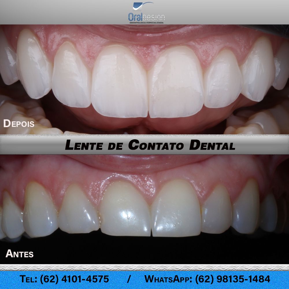 Danilo Monteiro Rezende Pereira-10