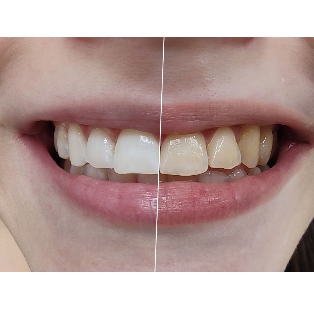 Mateus Rinaldi Lucio Martins-1