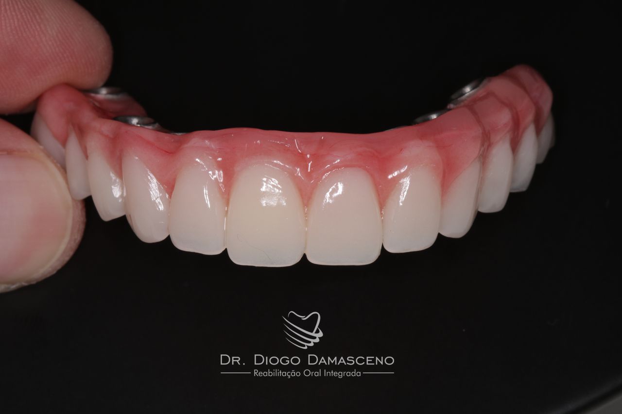 Diogo Damasceno-39