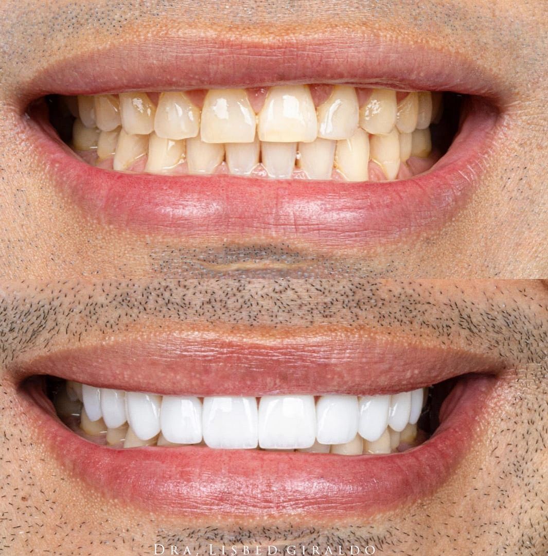 Lisbed Giraldo Olarte-45