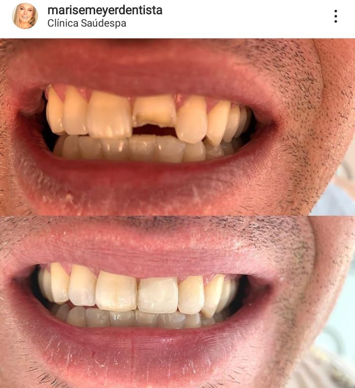 Marise Meyer Jamur-14