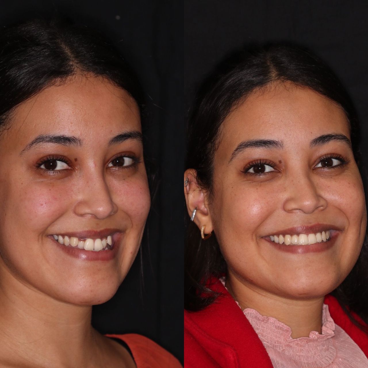 Bruno Nifossi Prado-14