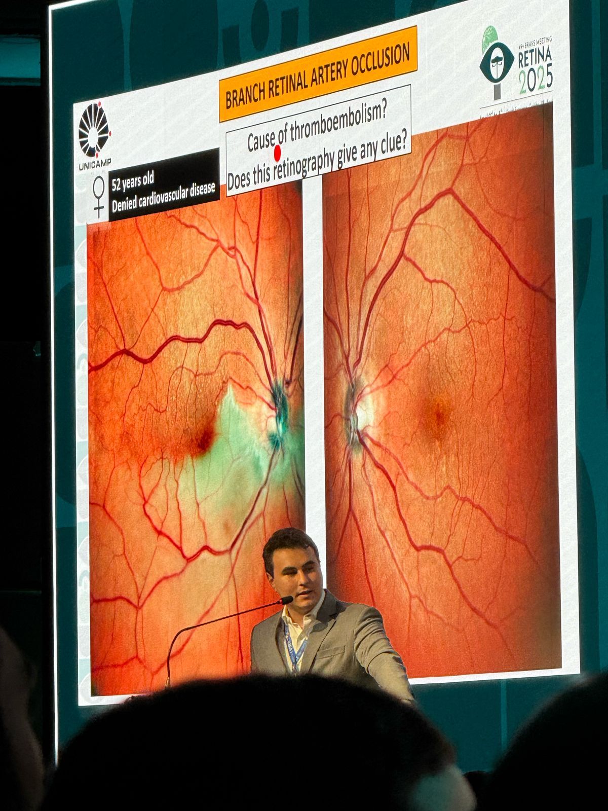 Matheus Schwengber Gasparini-0