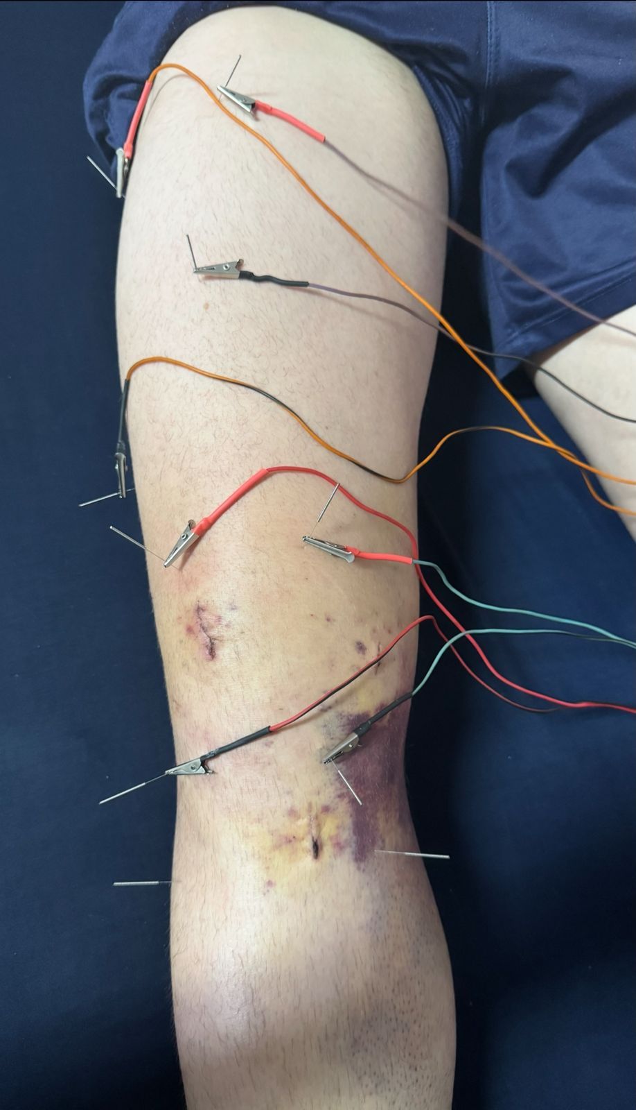 Rodrigo Klostermann Lechinoski-3