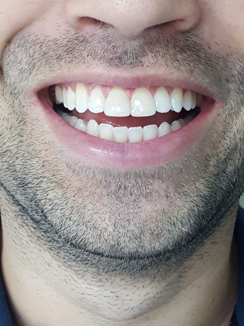 Gersa A. Domingues E Silva-7