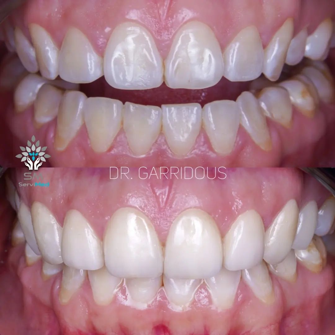 Javier Garrido Tirado-13