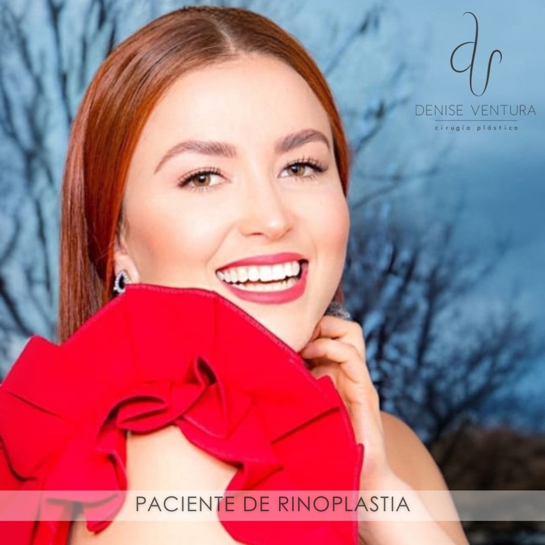 Denise Ventura Perez-11