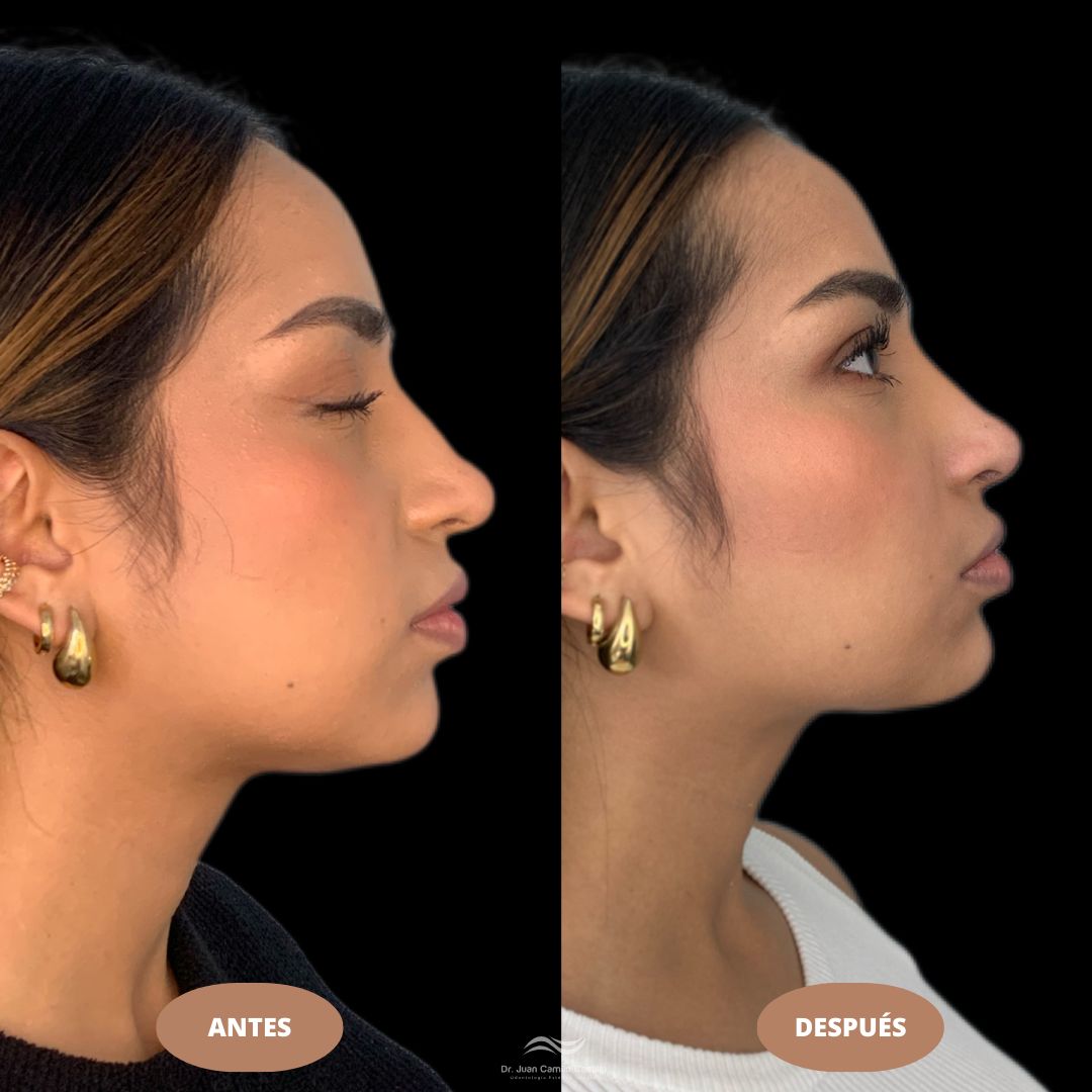 Juan Camilo Castillo-19