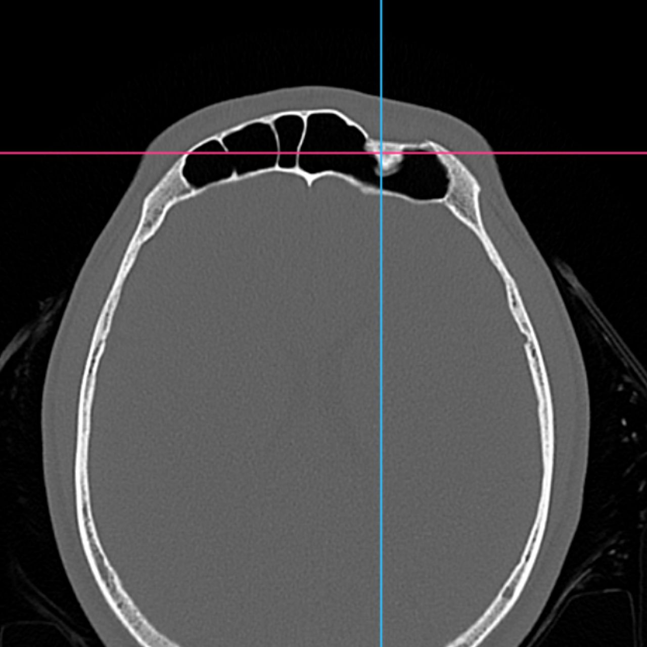 David Tafur Muñoz-1640