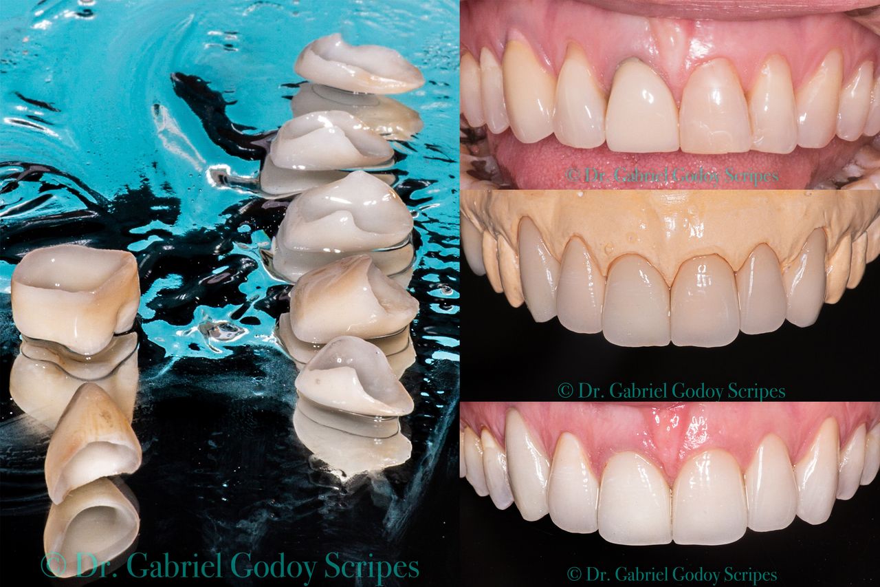 Gabriel Godoy Scripes-85