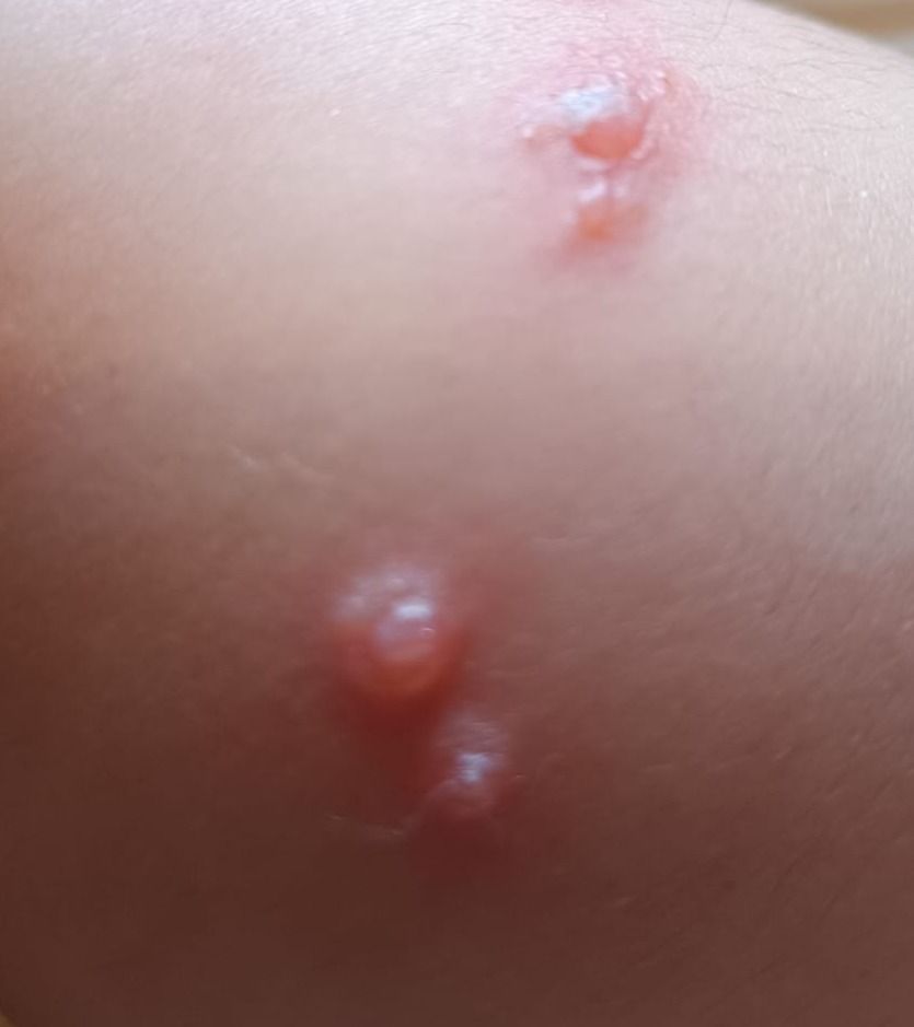 Marcos Ortiz Perez-8