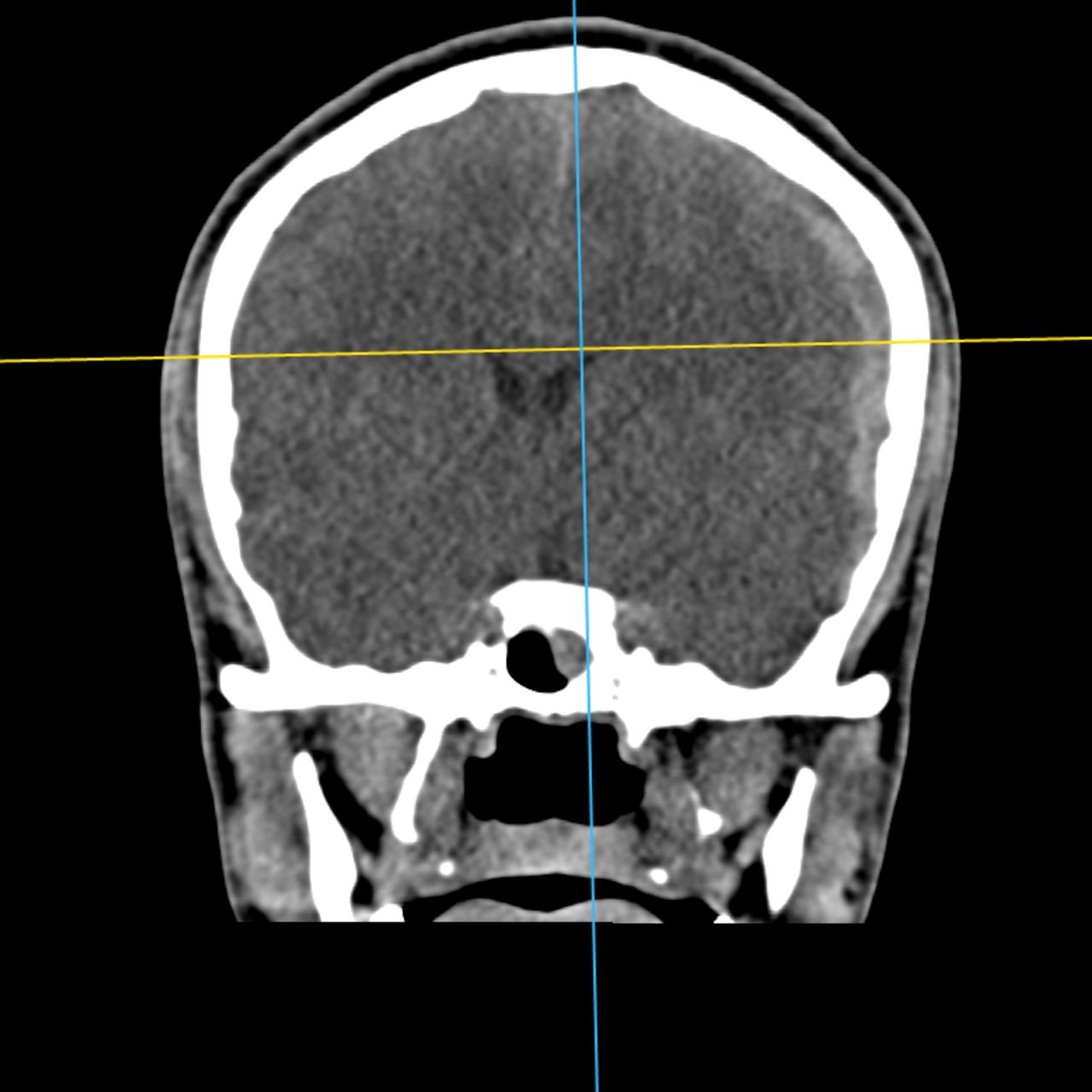 David Tafur Muñoz-2078