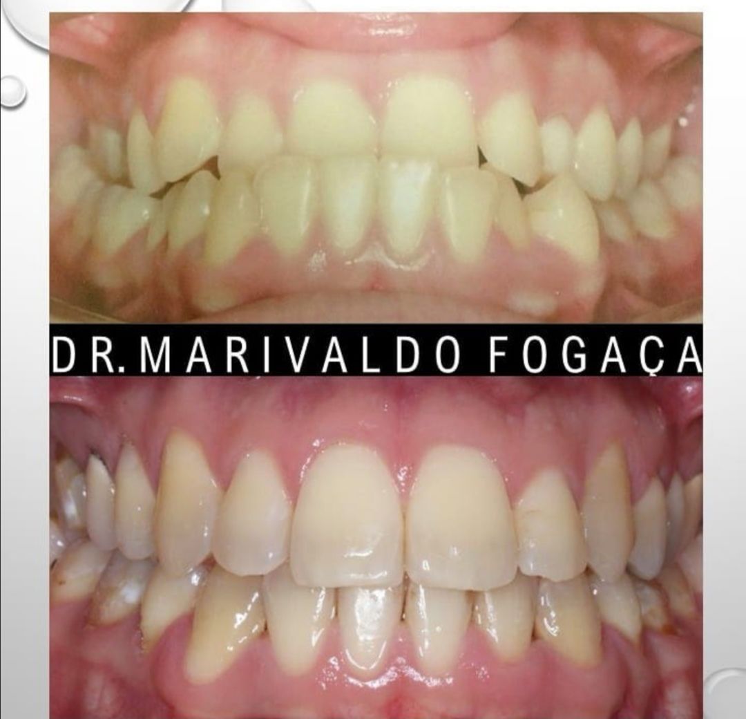 Marivaldo Fogaça-10